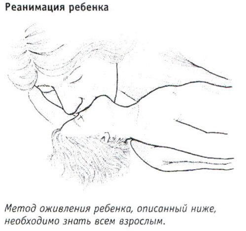 Реанимация ребенка Реанимация ребенка