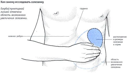 Как самому исследовать селезенку Как самому исследовать селезенку