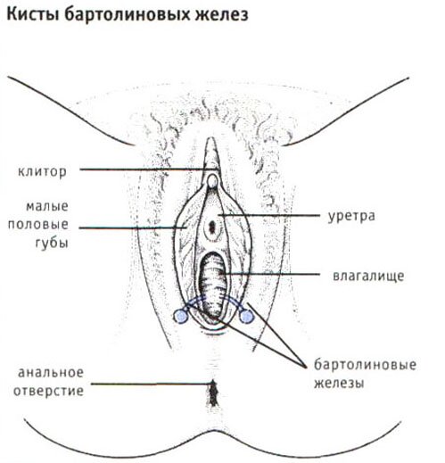 Кисты бартолиновых желез Кисты бартолиновых желез