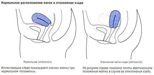 Положения матки Положения матки